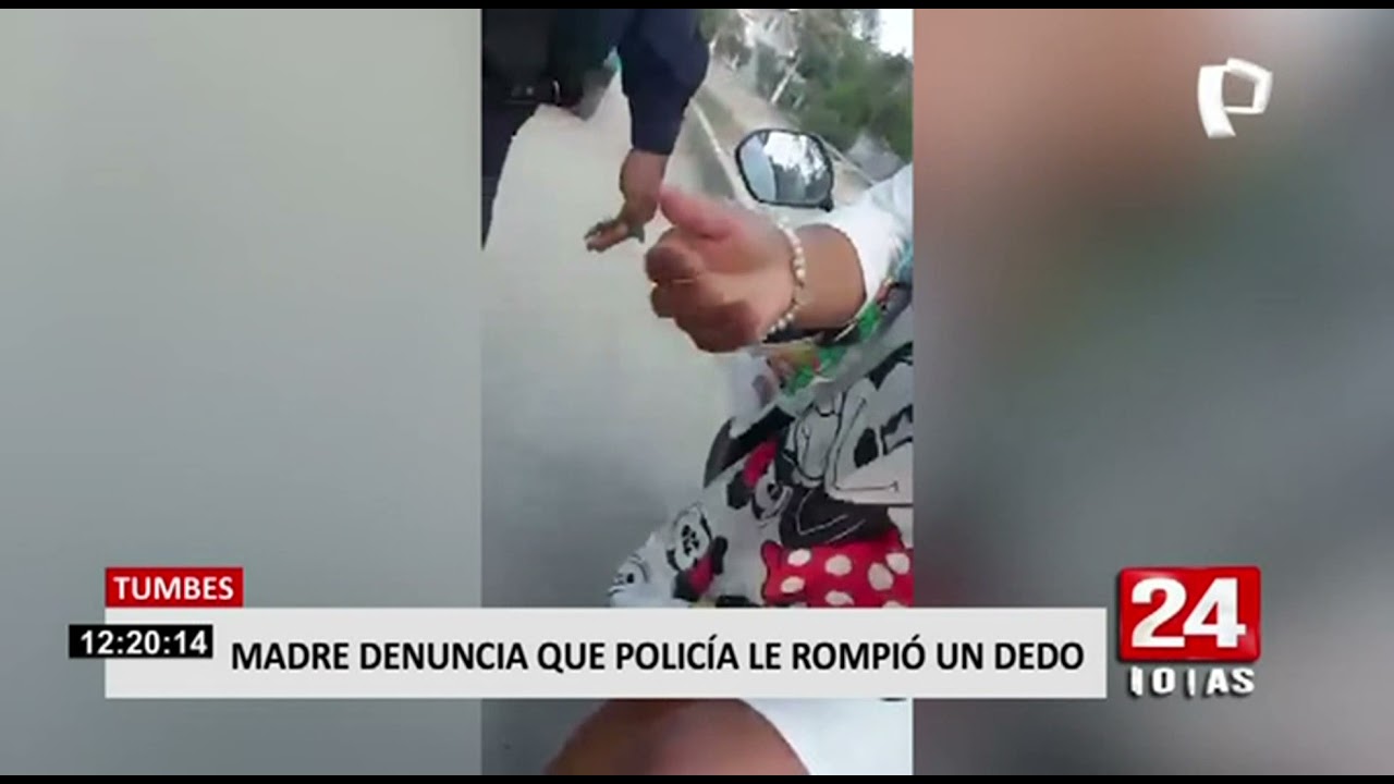 Tumbes: mujer denuncia que policía le rompió el dedo durante intervención (1/2)