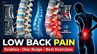 Low Back Pain Explained | Causes, Sciatica, L4-L5 Disc Bulge, Exercises & Physiotherapy screenshot 4
