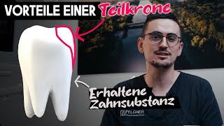 Zahn erhalten statt Wegschleifen. Warum Teilkronen so viele Vorteile bieten.