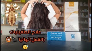 علاج القمل في 24 ساعة   وماهي أسباب ضهور القمل في الرأس 