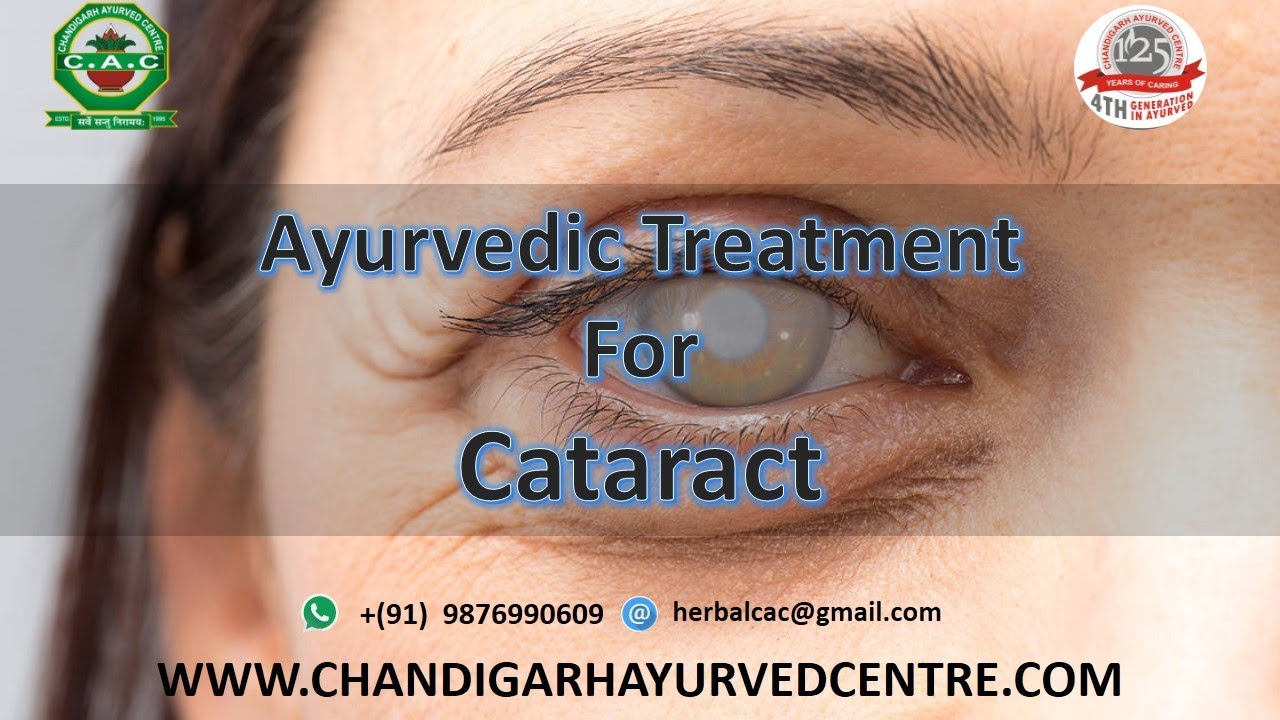 Ayurvedic Treatment For Cataract Chandigarh Ayurved Centre YouTube