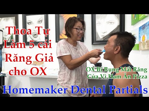 Video #36 Thoa Tự Làm 5 cái Răng Giả cho OX. Homemaker... - youtube