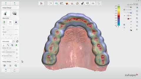 Der allgemeine Workflow für Splint Studio