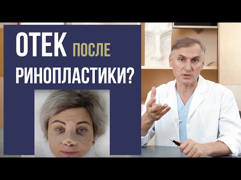 ОТЕК ПОСЛЕ РИНОПЛАСТИКИ 🤭😱 ПРОБЛЕМА❓