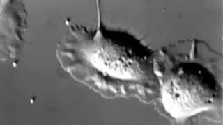 01 2 Keratocyte Dance