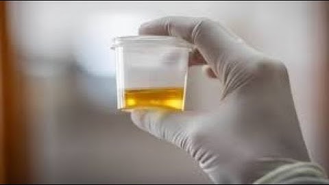 Urinalysis CPT codes - simplify medical coding