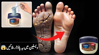 Get Beautiful Soft Feet & Cracked Heels Removal Super Home Remedy with Vaseline & Baking Soda screenshot 1