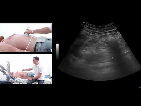 How to perform an ultrasound exam of the pancreas