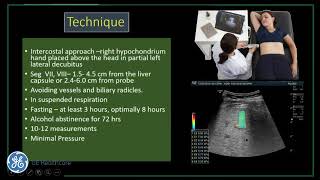 GE Webinar :Chronic Liver Disease, Elastography & Portal Hypertension screenshot 5