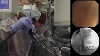 Spectrum Health: new treatment for COPD