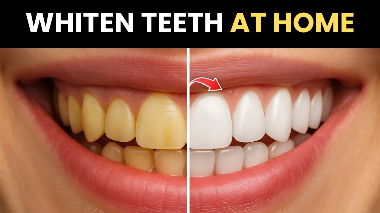 Whiten Your Teeth at Home FAST with 2 Simple Ingredients – No Expensive ...