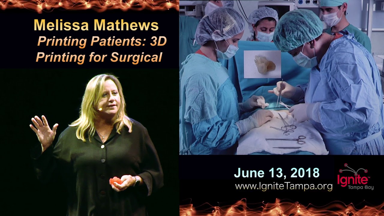 Ignite Tampa Bay 2018: Melissa Mathews - Printing Patients; 3D Printing