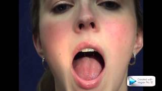 Independent Tongue - Pollard and Perrin Orthodontics