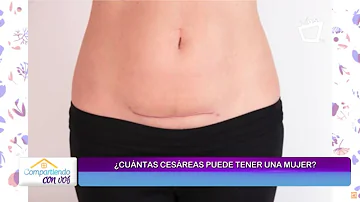 ¿Cuántas cesáreas se pueden hacer?