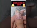 Descamación de Uñas 💅 Por Qué Se Pelan y Cómo Repararlas Correctamente