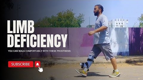 Looking for the best quality artificial leg,visit GetBak - Rajkot, Ahmedabad or Mehsana in Gujarat