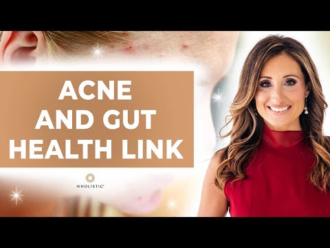 Acne and Gut Health Link 🔗