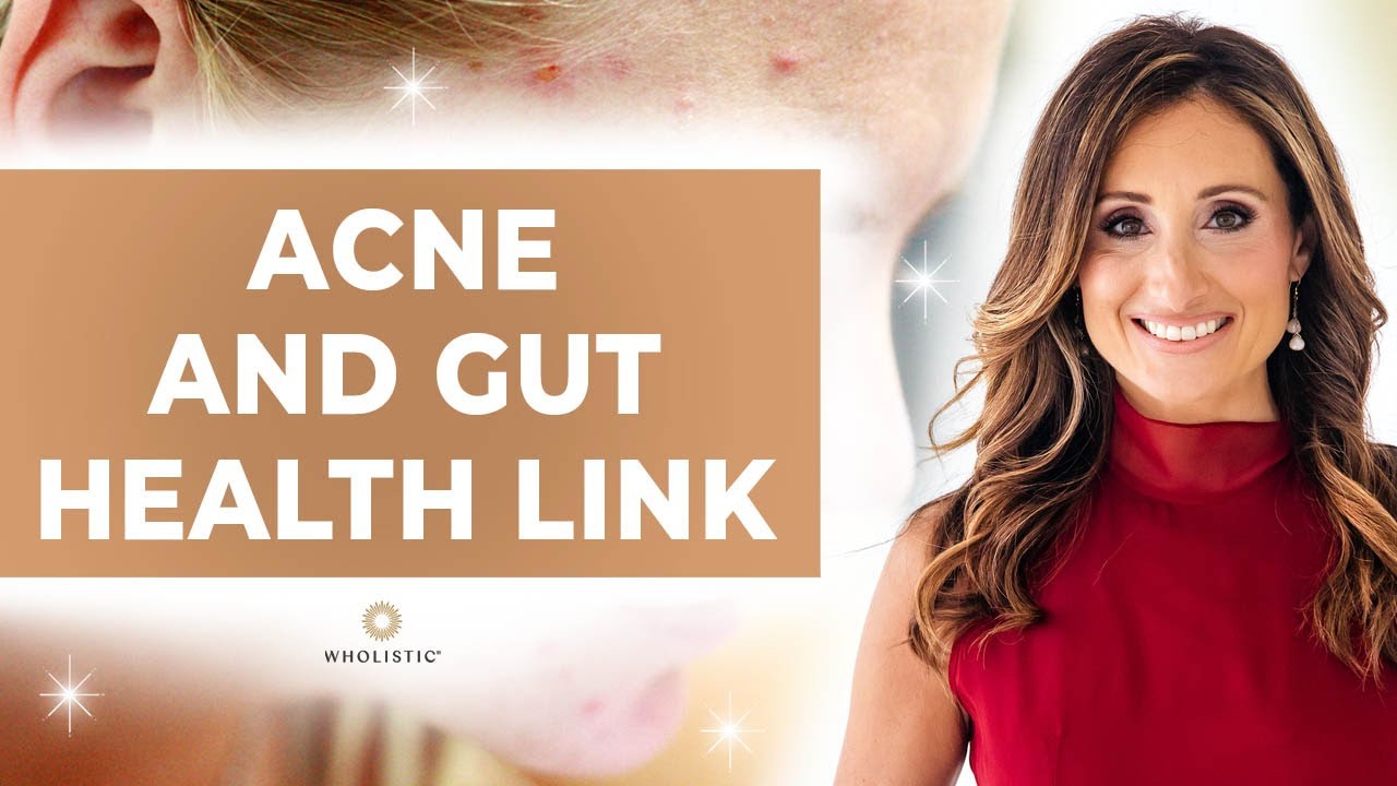 Acne and Gut Health Link 🔗 - YouTube