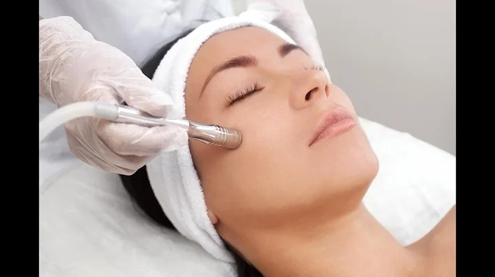Tutorial: Microdermabrasio...
