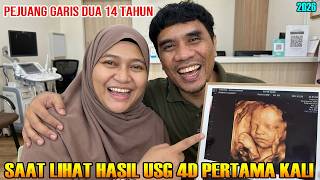 Saat Lihat Hasil USG 4D Pertama Kali | Pejuang Garis Dua 14 Tahun | 2026