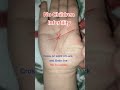 Infertility But Cureable Palmistry Palmreadings Fortuner Kids Children Cure Life Cross Infertility But Cureable Palmistry Palmreadings Fortuner Kids Children Cure Life Cross