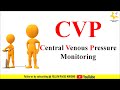 Central Venous Pressure monitoring | CVP monitoring | High CVP | Low CVP