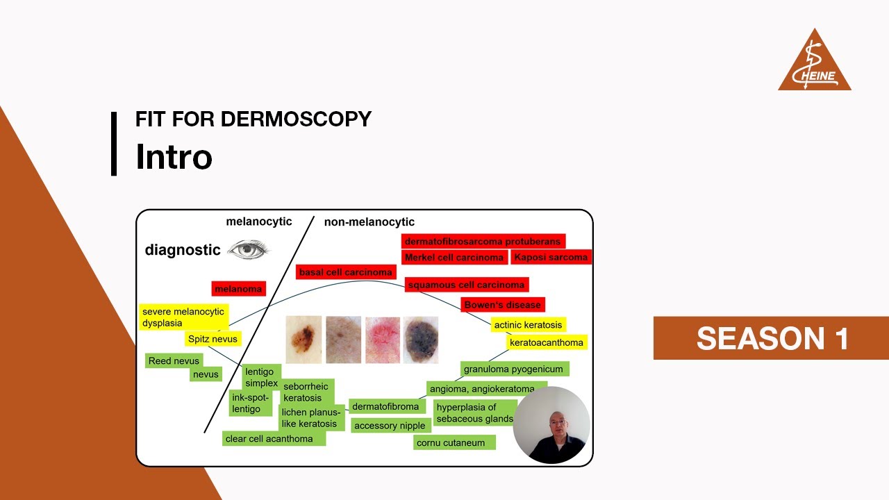Fit for Dermoscopy Intro — Video course on skin cancer diagnostics by Prof. Andreas Blum