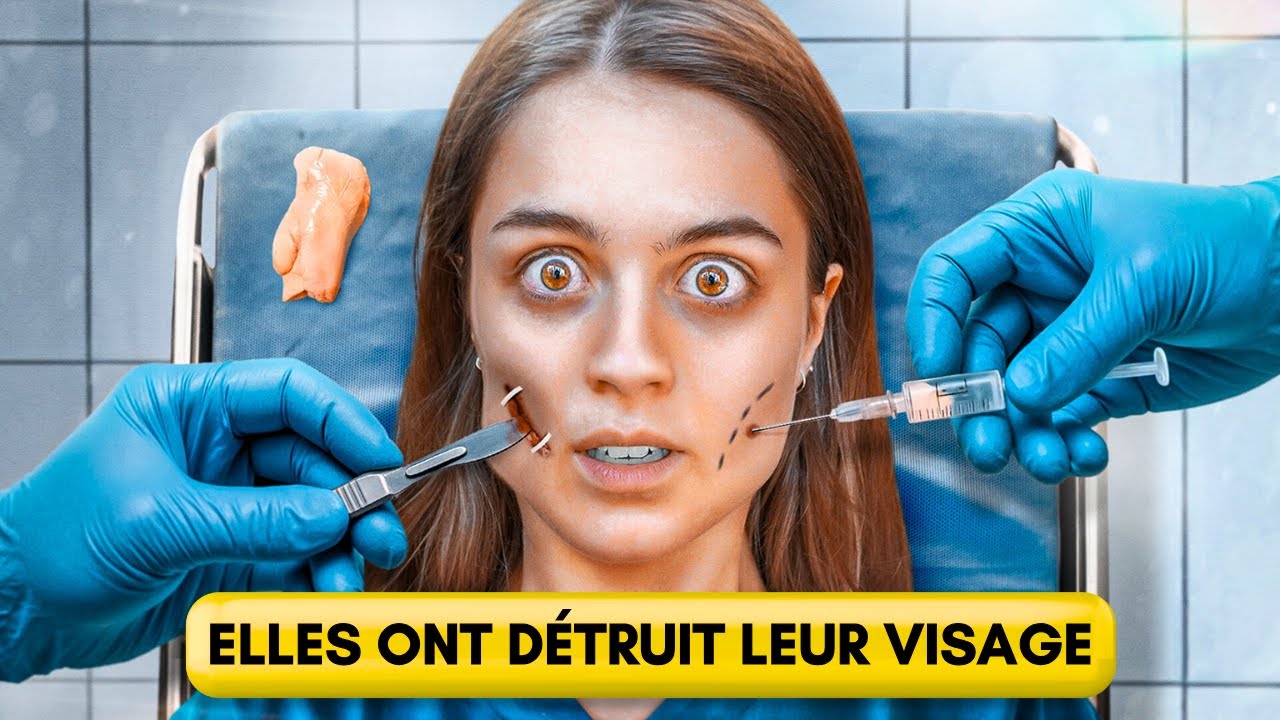 LA CHIRURGIE SECRÈTE QUI DÉFORME DES VISAGES POUR TOUJOURS | La bichectomie