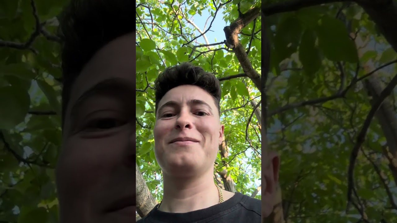 Prank mamit: Do mbjell flokët në Turqi me 5000€ – reagimi ishte çmenduri 😂