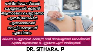 How to Determine Baby Gender During an Ultrasound Scan | Pregnancy | Dr. Sithara