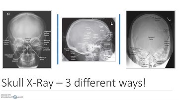Classroom Assessment Technique - Memory Matrix