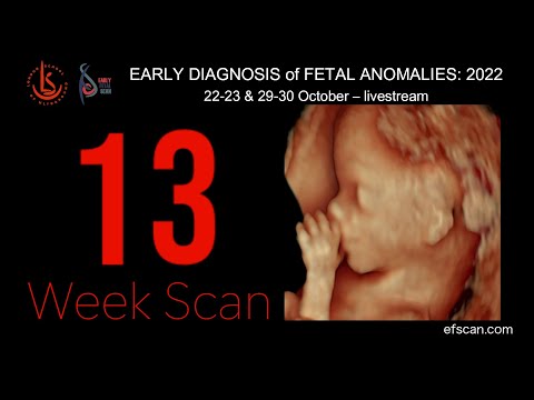 13 Week Scan - EARLY DIAGNOSIS of FETAL ANOMALIES 2022