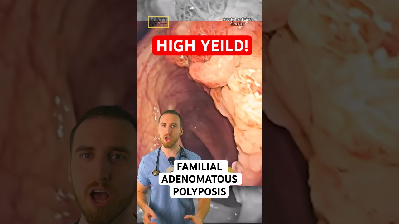 Familial adenomatous polyposis explained!
