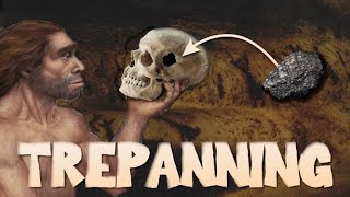 The History of Trepanning