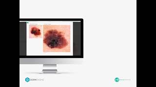 DermEngine for Intelligent Dermatology