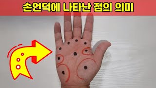 손언덕에 나타난 점의 의미 (재미있는 손금)