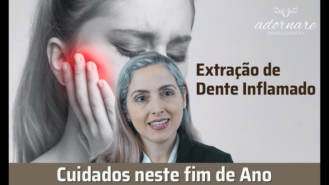 Extração de Dente Inflamado - Como Devemos Proceder - Dicas de Saúde ...
