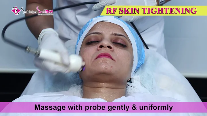 Radio Frequency  (RF) Skin Tightening    |    Sakhiya Skin Clinic