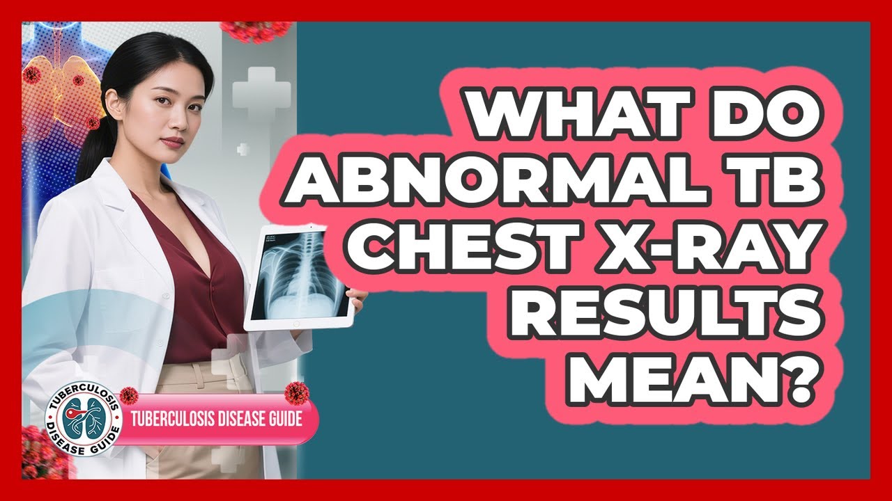 What Do Abnormal TB Chest X-ray Results Mean?