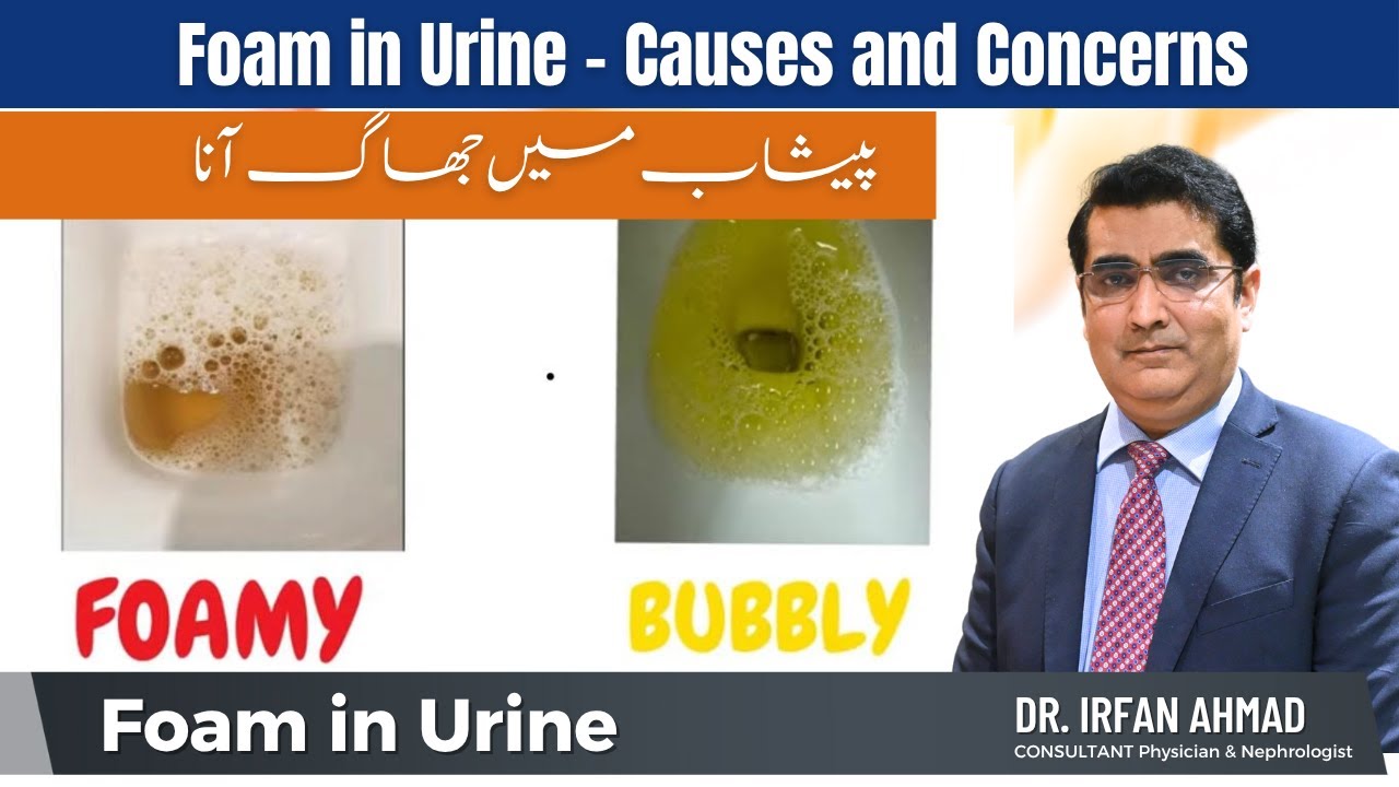 🧪 Foamy vs. Bubbly Urine – What Does It Mean?
