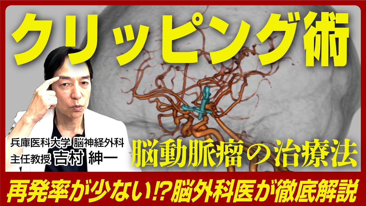 手術動画あり！脳動脈瘤に対するクリッピング術とは？ - YouTube