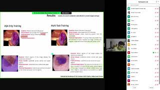 Medico 2025:  Multi-Task Learning for Visually Grounded Reasoning in Gastrointestinal VQA
