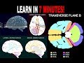 Brain Blood Supply Quiz