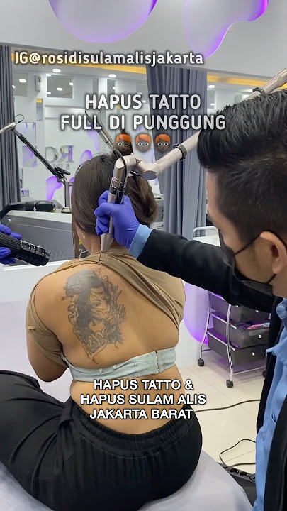HAPUS TATTO DI PUNGGUNG‼️ TATTO NYA BESAR BANGET #sulamalisrosidi