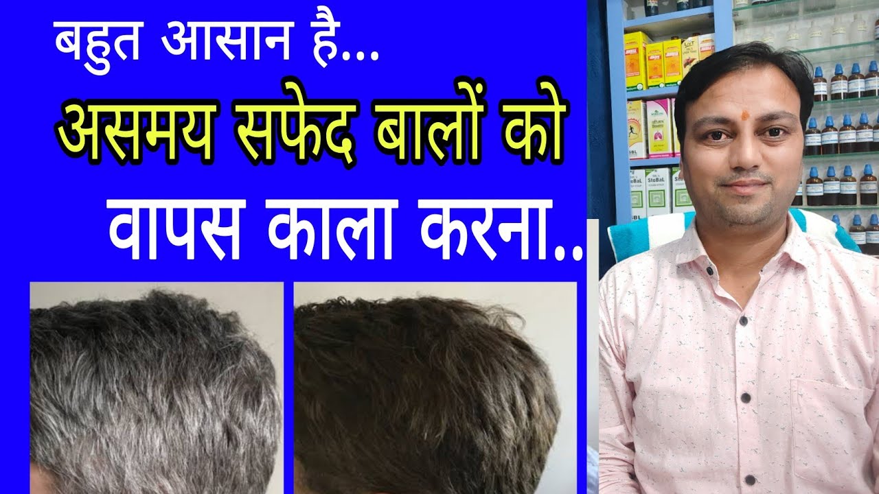 असमय सफेद बालों का आसान इलाज, Premature graying of hair treatment in