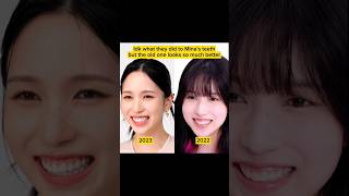 MINA NEW SMILE WITH VENEERS? what do you think? #mina #veneers #myouimina #twicemina #once4ever MINA NEW SMILE WITH VENEERS? what do you think? #mina #veneers #myouimina #twicemina #once4ever