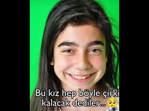 bu kız hep böyle çirkin kalacak dediler ve sonuç