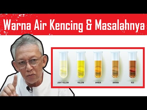 11 WARNA AIR KENCING & Apa Masalahnya? Termasuk yang BERBUIH