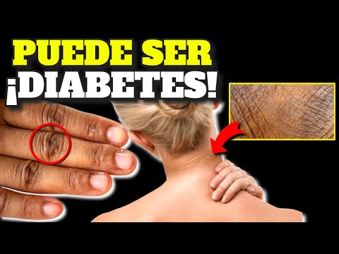 Video: ¿Podría tener diabetes? Cómo reconocer las señales de alerta temprana