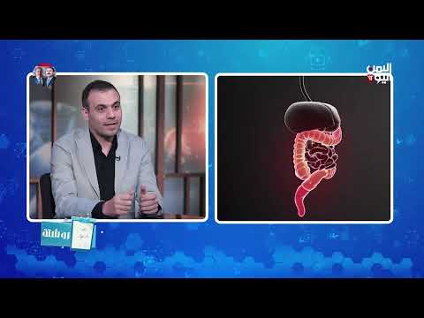 القولون العصبي وصيام رمضان... تعليمات مهمة في روشتة